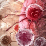 cancer