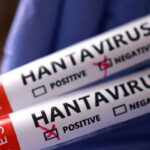 hanta-virus