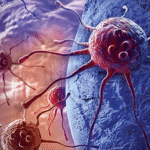 CANCER