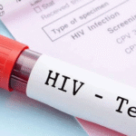 HIV