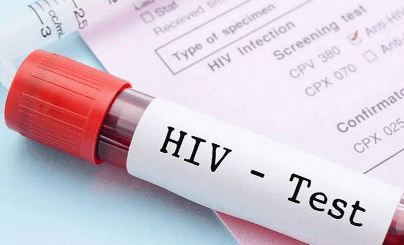 HIV