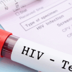 hiv