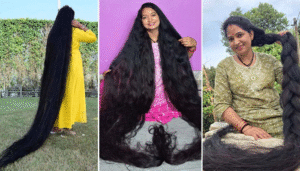 hairs