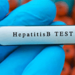 hapatitis