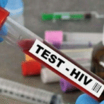 hiv