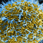 polio