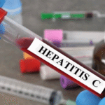 hypatitus