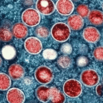 mpox